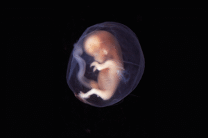 Ibu dan Bayi Meninggal dalam Kandungan Haruskah Dikeluarkan
